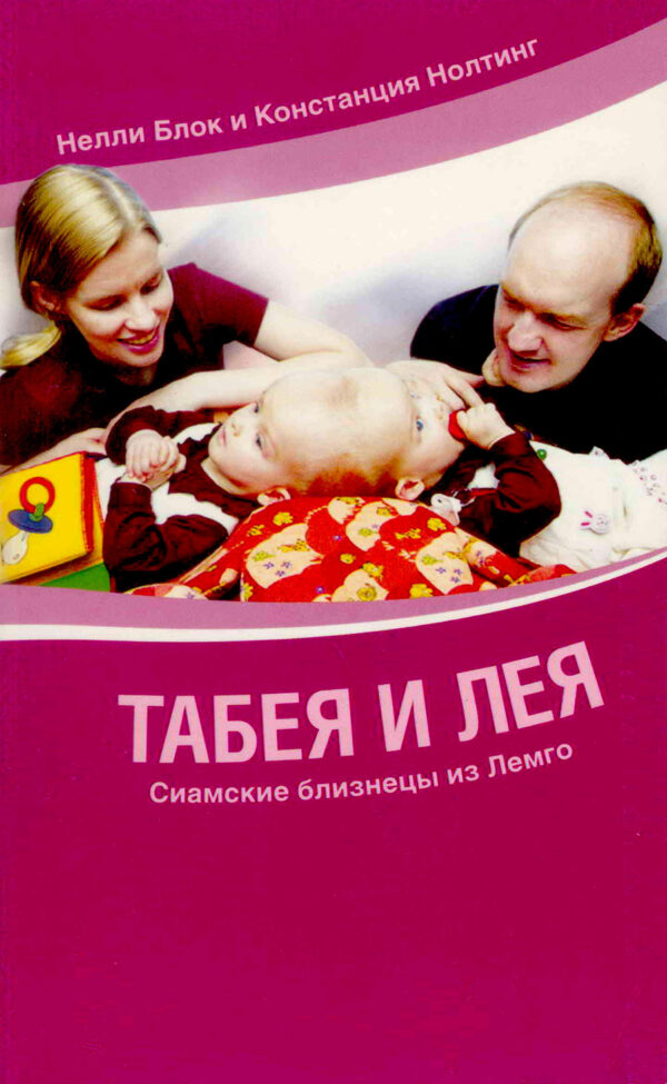 Табея и Лея. Сиамские близнецы из Лемго